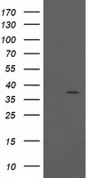 PIH1D2 Antibody - HEK293T cells were transfected with the pCMV6-ENTRY control (Left lane) or pCMV6-ENTRY PIH1D2 (Right lane) cDNA for 48 hrs and lysed. Equivalent amounts of cell lysates (5 ug per lane) were separated by SDS-PAGE and immunoblotted with anti-PIH1D2.