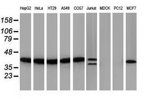 PIH1D2 Antibody - Western blot of extracts (35 ug) from 9 different cell lines by using anti-PIH1D2 monoclonal antibody.
