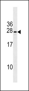 PIH1D3 Antibody - CXorf41 Antibody western blot of NCI-H460 cell line lysates (35 ug/lane). The CXorf41 antibody detected the CXorf41 protein (arrow).