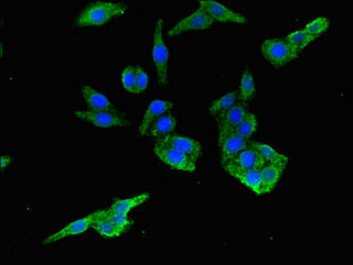PIH1D3 Antibody - Immunofluorescent analysis of HepG2 cells using PIH1D3 Antibody at dilution of 1:100 and Alexa Fluor 488-congugated AffiniPure Goat Anti-Rabbit IgG(H+L)