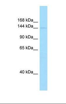 PIK3C2A Antibody - Western blot of Human Hela. PIK3C2A antibody dilution 1.0 ug/ml.  This image was taken for the unconjugated form of this product. Other forms have not been tested.