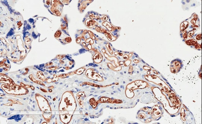 PIK3C2A Antibody - PIK3C2A antibody (2µg/ml) staining of paraffin embedded Human Placenta. Microwaved antigen retrieval with citrate buffer pH 6, HRP-staining.