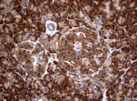 PIK3C2A Antibody - IHC of paraffin-embedded Human pancreas tissue using anti-PIK3C2A mouse monoclonal antibody. (Heat-induced epitope retrieval by 10mM citric buffer, pH6.0, 120°C for 3min).