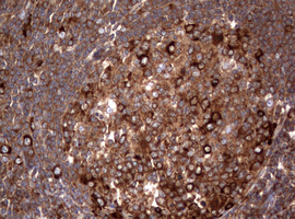PIK3C2A Antibody - IHC of paraffin-embedded Human tonsil using anti-PIK3C2A mouse monoclonal antibody. (Heat-induced epitope retrieval by 10mM citric buffer, pH6.0, 120°C for 3min).
