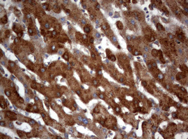 PIK3C2A Antibody - IHC of paraffin-embedded Human liver tissue using anti-PIK3C2A mouse monoclonal antibody. (Heat-induced epitope retrieval by 10mM citric buffer, pH6.0, 120°C for 3min).