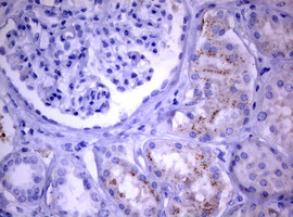 PIK3C2A Antibody - IHC of paraffin-embedded Human Kidney tissue using anti-PIK3C2A mouse monoclonal antibody. (Heat-induced epitope retrieval by 10mM citric buffer, pH6.0, 120°C for 3min).