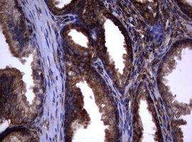 PIK3C2A Antibody - IHC of paraffin-embedded Human prostate tissue using anti-PIK3C2A mouse monoclonal antibody. (Heat-induced epitope retrieval by 10mM citric buffer, pH6.0, 120°C for 3min).