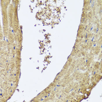 PIK3C2A Antibody - Immunohistochemistry of paraffin-embedded mouse heart using PIK3C2A antibody at dilution of 1:100 (x40 lens).