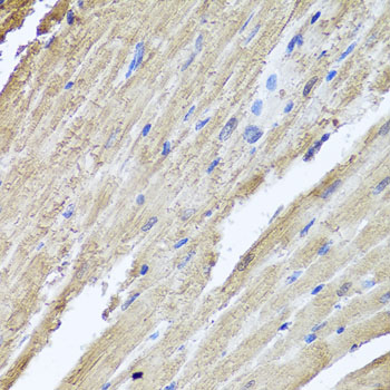 PIK3C2A Antibody - Immunohistochemistry of paraffin-embedded rat heart using PIK3C2A antibody at dilution of 1:100 (x40 lens).