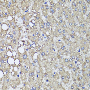 PIK3C2A Antibody - Immunohistochemistry of paraffin-embedded human liver injury using PIK3C2A antibody at dilution of 1:100 (x40 lens).