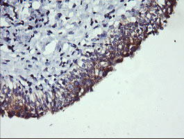 PIK3C2B Antibody - IHC of paraffin-embedded Human bladder tissue using anti-PIK3C2B mouse monoclonal antibody.