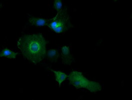 PIK3C2B Antibody - Anti-PIK3C2B mouse monoclonal antibody immunofluorescent staining of COS7 cells transiently transfected by pCMV6-ENTRY PIK3C2B.