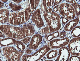 PIK3C2B Antibody - IHC of paraffin-embedded Human Kidney tissue using anti-PIK3C2B mouse monoclonal antibody.