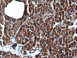 PIK3C2B Antibody - IHC of paraffin-embedded Human pancreas tissue using anti-PIK3C2B mouse monoclonal antibody.