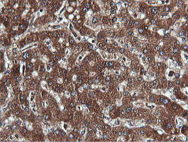 PIK3C2B Antibody - IHC of paraffin-embedded Human liver tissue using anti-PIK3C2B mouse monoclonal antibody.