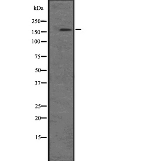 PIK3C2B Antibody - Western blot analysis of PIK3C2B expression in A431 cell lysates at 25ug/lane. The lane on the left is treated with the antigen-specific peptide.