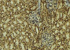 PIK3C2B Antibody - 1:100 staining mouse kidney tissue by IHC-P. The sample was formaldehyde fixed and a heat mediated antigen retrieval step in citrate buffer was performed. The sample was then blocked and incubated with the antibody for 1.5 hours at 22°C. An HRP conjugated goat anti-rabbit antibody was used as the secondary.