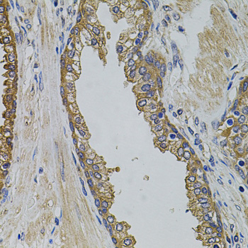 PIK3C3 / VPS34 Antibody - Immunohistochemistry of paraffin-embedded human prostate using PIK3C3 antibodyat dilution of 1:100 (40x lens).