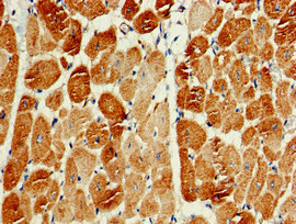 PIK3C3 / VPS34 Antibody - Immunohistochemistry of paraffin-embedded human heart tissue at dilution of 1:100
