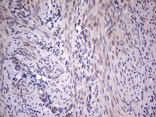 PIK3CA / PI3K Alpha Antibody - IHC of paraffin-embedded Human endometrium tissue using anti-PIK3CA mouse monoclonal antibody. (Heat-induced epitope retrieval by 1 mM EDTA in 10mM Tris, pH8.5, 120°C for 3min).