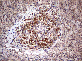PIK3CA / PI3K Alpha Antibody - IHC of paraffin-embedded Human lymph node tissue using anti-PIK3CA mouse monoclonal antibody. (Heat-induced epitope retrieval by 1 mM EDTA in 10mM Tris, pH8.5, 120°C for 3min).