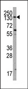 PIK3CA / PI3K Alpha Antibody - Western blot of anti-PIK3CA Antibody antibody in K562 cell line lysates (35 ug/lane). PIK3CA (arrow) was detected using the purified Pab