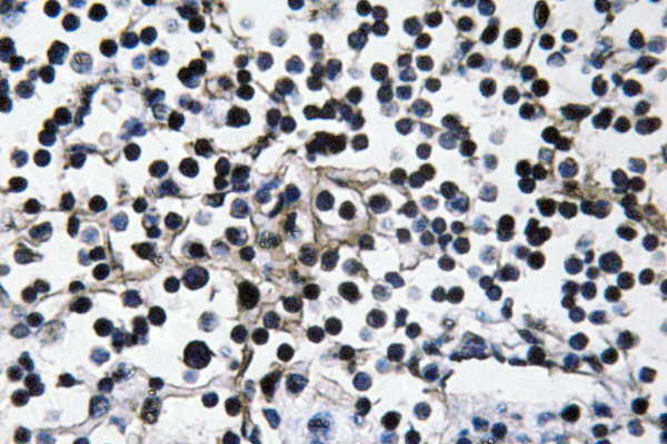 PIK3CA / PI3K Alpha Antibody - IHC of PI 3-kinase p110 (R519) pAb in paraffin-embedded human lymph node tissue.