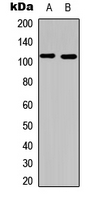 PIK3CA / PI3K Alpha Antibody - Western blot analysis of PI3K p110 alpha expression in HeLa (A); mouse liver (B) whole cell lysates.