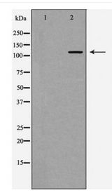 PIK3CA / PI3K Alpha Antibody - Western blot of PI3 kinase?P110 alpha expression in mouse liver