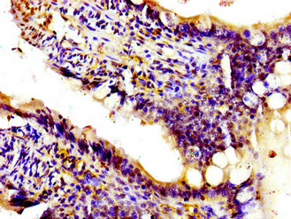 PIK3CA / PI3K Alpha Antibody - Immunohistochemistry image of paraffin-embedded human small intestine tissue at a dilution of 1:100