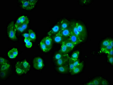 PIK3CA / PI3K Alpha Antibody - Immunofluorescence staining of HepG2 cells with PIK3CA Antibody at 1:133, counter-stained with DAPI. The cells were fixed in 4% formaldehyde, permeabilized using 0.2% Triton X-100 and blocked in 10% normal Goat Serum. The cells were then incubated with the antibody overnight at 4°C. The secondary antibody was Alexa Fluor 488-congugated AffiniPure Goat Anti-Rabbit IgG(H+L).