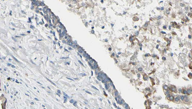 PIK3CA / PI3K Alpha Antibody - 1:100 staining human prostate tissue by IHC-P. The sample was formaldehyde fixed and a heat mediated antigen retrieval step in citrate buffer was performed. The sample was then blocked and incubated with the antibody for 1.5 hours at 22°C. An HRP conjugated goat anti-rabbit antibody was used as the secondary.