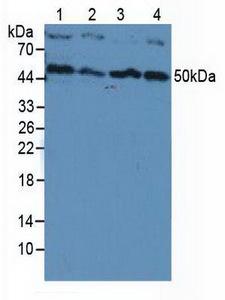 PIK3CB / PI3K Beta Antibody - Western Blot; Sample: Lane1: Human Hela Cells; Lane2: Human HepG2 Cells; Lane3: Human Jurkat Cells; Lane4: Human K-562 Cells.