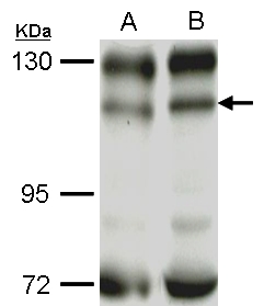 PIK3CB / PI3K Beta Antibody - Sample (50 ug of whole cell lysate). A: C2C12, B: C2C12+AEA10mM. PIK3CB antibody diluted at 1:1000.