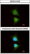 PIK3CB / PI3K Beta Antibody - Immunofluorescence of methanol-fixed HeLa using PI3 kinase p110 beta antibody at 1:200 dilution.