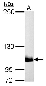 PIK3CB / PI3K Beta Antibody - PI3 kinase p110 beta antibody [N3C2], Internal detects PIK3CB protein by Western blot analysis. A. 30 ug PC-12 whole cell lysate/extract. 5 % SDS-PAGE. PI3 kinase p110 beta antibody [N3C2], Internal dilution:1:1000