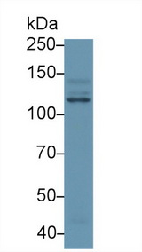 PIK3CB / PI3K Beta Antibody - Western Blot; Sample: Human Hela cell lysate; Primary Ab: 1µg/ml Rabbit Anti-Human PIK3Cb Antibody Second Ab: 0.2µg/mL HRP-Linked Caprine Anti-Rabbit IgG Polyclonal Antibody
