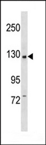 PIK3CB / PI3K Beta Antibody - PI3KCB Antibody (C-term K727) western blot of CEM cell line lysates (35 ug/lane). The PI3KCB antibody detected the PI3KCB protein (arrow).