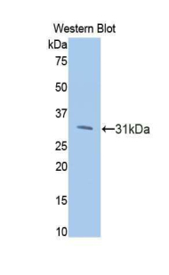 PIK3CB / PI3K Beta Antibody - Western blot of recombinant PIK3CB.  This image was taken for the unconjugated form of this product. Other forms have not been tested.