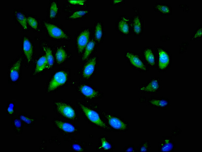 PIK3CB / PI3K Beta Antibody - Immunofluorescent analysis of Hela cells at a dilution of 1:100 and Alexa Fluor 488-congugated AffiniPure Goat Anti-Rabbit IgG(H+L)