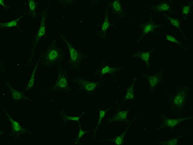 PIK3CB / PI3K Beta Antibody - Immunofluorescence staining of PIK3CB in Hela cells. Cells were fixed with 4% PFA, permeabilzed with 0.1% Triton X-100 in PBS, blocked with 10% serum, and incubated with rabbit anti-human PIK3CB polyclonal antibody (dilution ratio 1:200) at 4°C overnight. Then cells were stained with the Alexa Fluor 488-conjugated Goat Anti-rabbit IgG secondary antibody (green). Positive staining was localized to Nucleus.