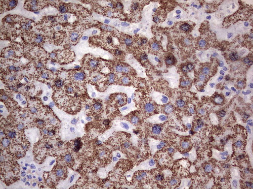 PIK3CD / PI3K Delta Antibody - IHC of paraffin-embedded Human liver tissue using anti-PIK3CD mouse monoclonal antibody. (Heat-induced epitope retrieval by 1 mM EDTA in 10mM Tris, pH8.5, 120°C for 3min).