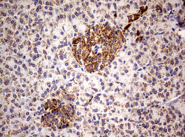 PIK3CD / PI3K Delta Antibody - IHC of paraffin-embedded Human pancreas tissue using anti-PIK3CD mouse monoclonal antibody. (Heat-induced epitope retrieval by 1 mM EDTA in 10mM Tris, pH8.5, 120°C for 3min).