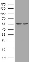 PIK3CD / PI3K Delta Antibody - E.coli lysate (left lane) and E.coli lysate expressing Human recombinant protein fragment (right lane) corresponding to amino acids 286-610 of human PIK3CD (NP_005017).