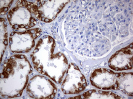 PIK3CD / PI3K Delta Antibody - IHC of paraffin-embedded Human Kidney tissue using anti-PIK3CD mouse monoclonal antibody. (Heat-induced epitope retrieval by 1 mM EDTA in 10mM Tris, pH8.5, 120°C for 3min).