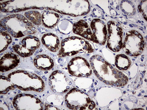 PIK3CD / PI3K Delta Antibody - IHC of paraffin-embedded Human Kidney tissue using anti-PIK3CD mouse monoclonal antibody. (Heat-induced epitope retrieval by 1 mM EDTA in 10mM Tris, pH8.5, 120°C for 3min).