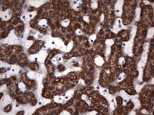 PIK3CD / PI3K Delta Antibody - IHC of paraffin-embedded Human liver tissue using anti-PIK3CD mouse monoclonal antibody. (Heat-induced epitope retrieval by 1 mM EDTA in 10mM Tris, pH8.5, 120°C for 3min).
