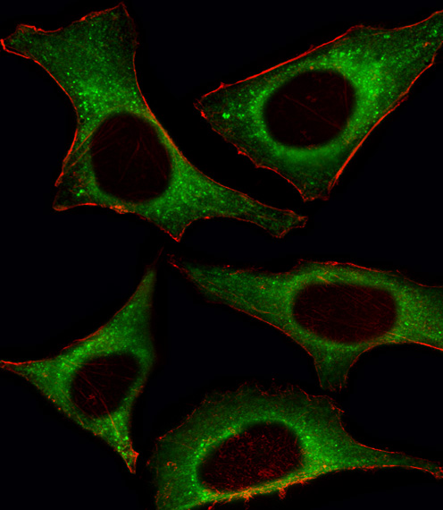 PIK3CD / PI3K Delta Antibody - Fluorescent image of HeLa cell stained with PI3KCD Antibody. HeLa cells were fixed with 4% PFA (20 min), permeabilized with Triton X-100 (0.1%, 10 min), then incubated with PI3KCD primary antibody (1:25, 1 h at 37°C). For secondary antibody, Alexa Fluor 488 conjugated donkey anti-rabbit antibody (green) was used (1:400, 50 min at 37°C). Cytoplasmic actin was counterstained with Alexa Fluor 555 (red) conjugated Phalloidin (7units/ml, 1 h at 37°C). PI3KCD immunoreactivity is localized to Cytoplasm significantly.