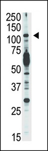 PIK3CD / PI3K Delta Antibody - Western blot of anti-PI3KCD antibody in Jurkat cell lysate. PI3KCD (arrow) was detected using purified antibody. Secondary HRP-anti-rabbit was used for signal visualization with chemiluminescence.