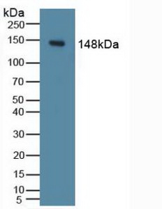 PIK3CD / PI3K Delta Antibody - Western Blot; Sample: Mouse Liver Tissue.